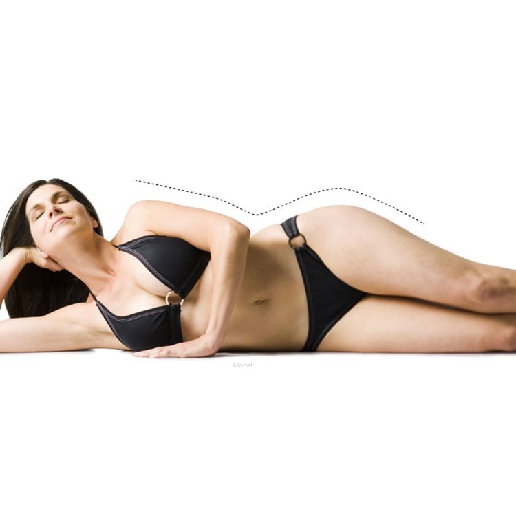 Ultrashape Featured Model