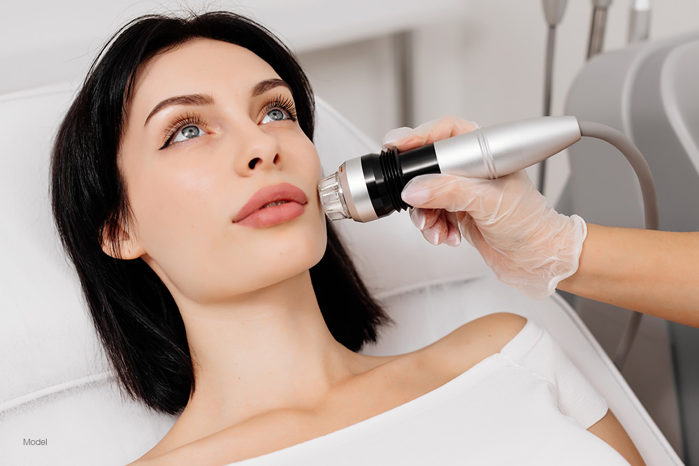 Woman getting microneedling done